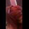 video thumb