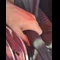 video thumb