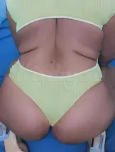 kora-prive-ontvangst-via-kinky-69ee2ba2c8ef3c00136f6035