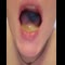 video thumb